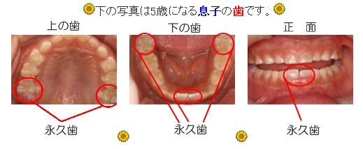 キャプチャ